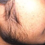 चेहरे के अनचाहे बाल से है परेशान, तो हटाने के लिए करें उपाय