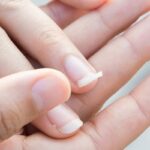 पार्टी से पहले नाखून टूट जाते हैं, तो अपनाएं ये घरेलू नुस्खें