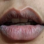 डेड स्किन जमने से होती हैं होंठों के कालेपन की समस्या, करें ये उपाय