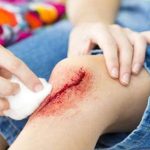 चोट से नहीं रुक रहा खून, तो फौरन करें ये उपाय