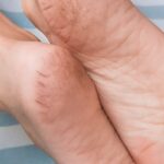 फटी एडियां करती है शर्मिंदा, इन टिप्स से बनाएँ सॉफ्ट