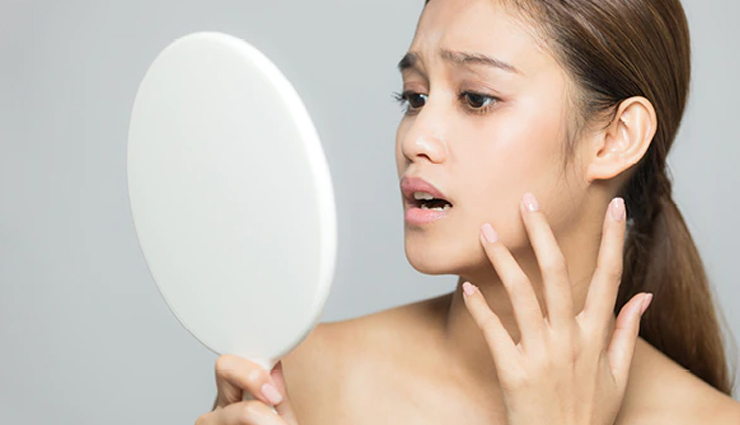 मस्सों से हैं परेशान, तो ट्राई करें ये घरेलू उपचार